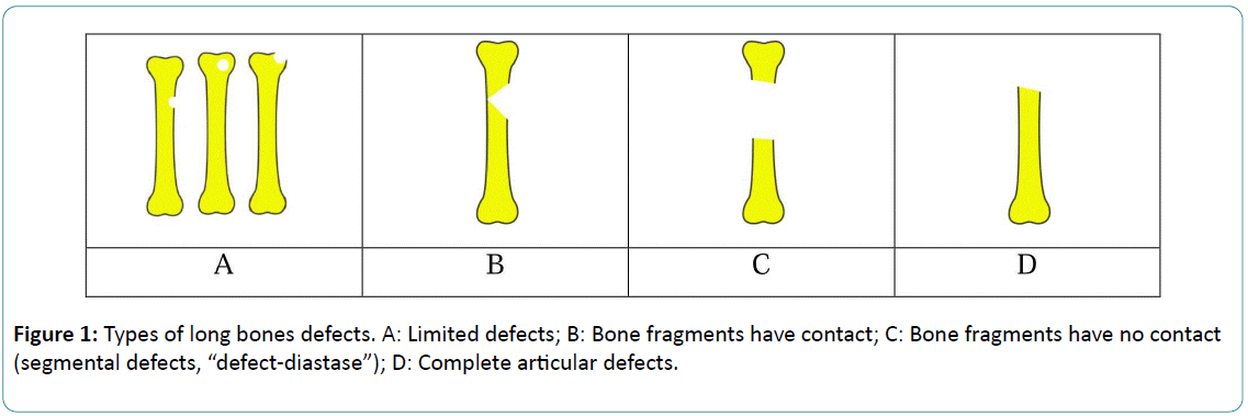 Bone-Reports-Recommendations-Complete-articular-defects