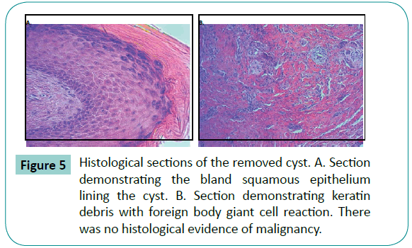 Bone-Reports-Recommendations-Histological-sections