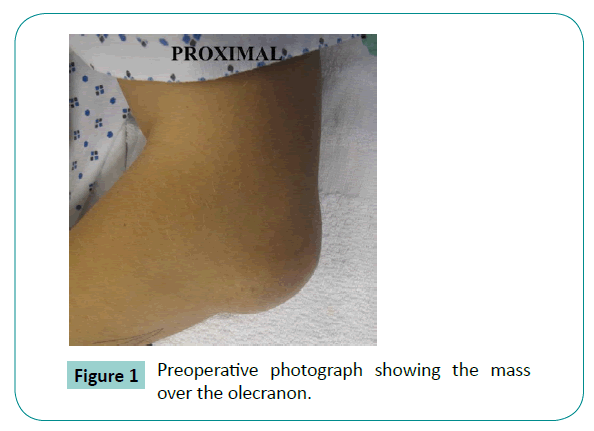 Bone-Reports-Recommendations-Preoperative-photograph