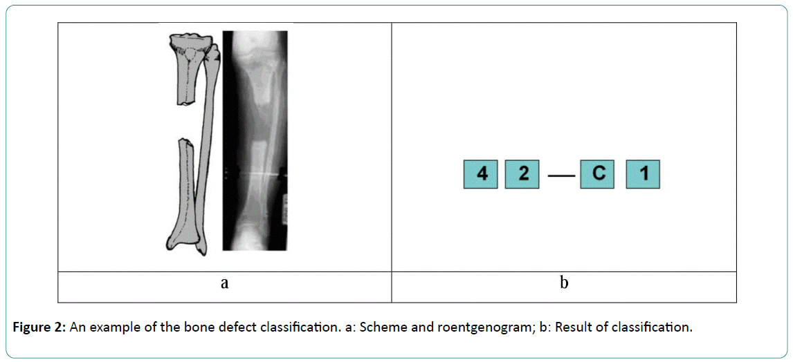 Bone-Reports-Recommendations-Result-classification