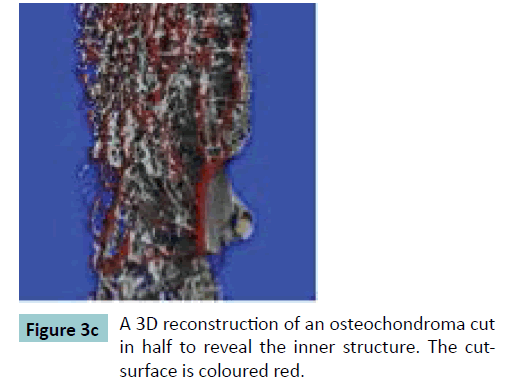 bone-3D-reconstruction
