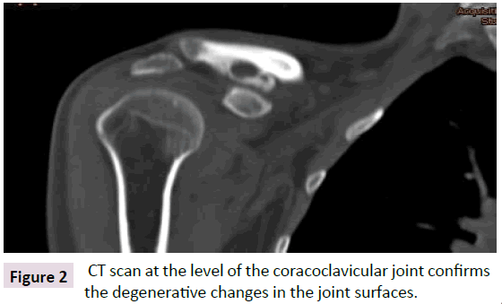 bone-CT-scan-level