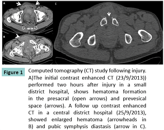 bone-Computed-tomography-study