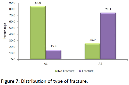 bone-Distribution-type-fracture