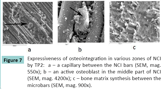 bone-Expressiveness-osteointegration-various-zones