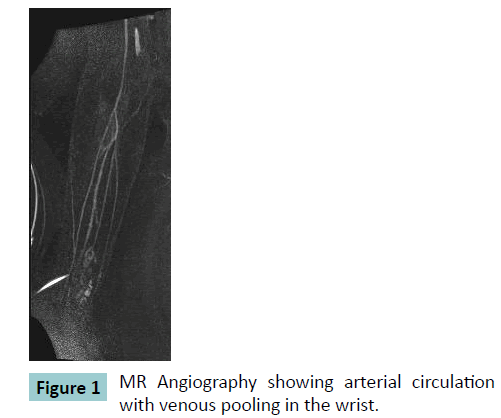 bone-MR-Angiography