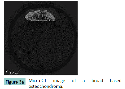 bone-Micro-CT-image