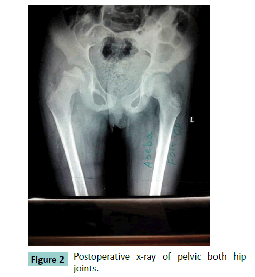 bone-Postoperative-x-ray