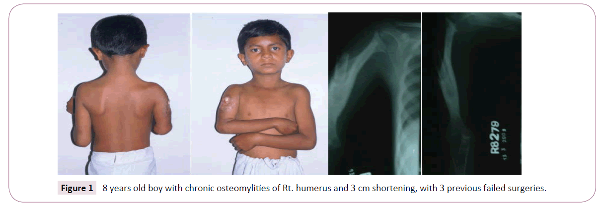 bone-reports-recommendations-failed-surgeries