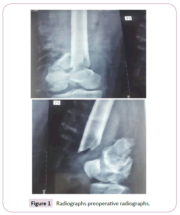 bone-reports-recommendations-preoperative-radiographs